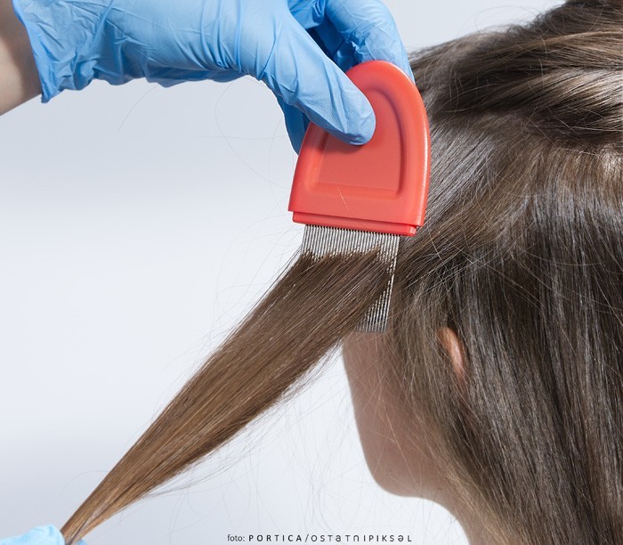 Wyczesywanie wszy z włosów