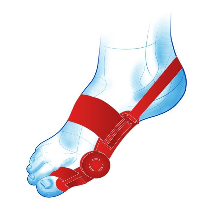 Mazbit CORRECTOR PRO - aparat korekcyjny na haluksa z regulacją