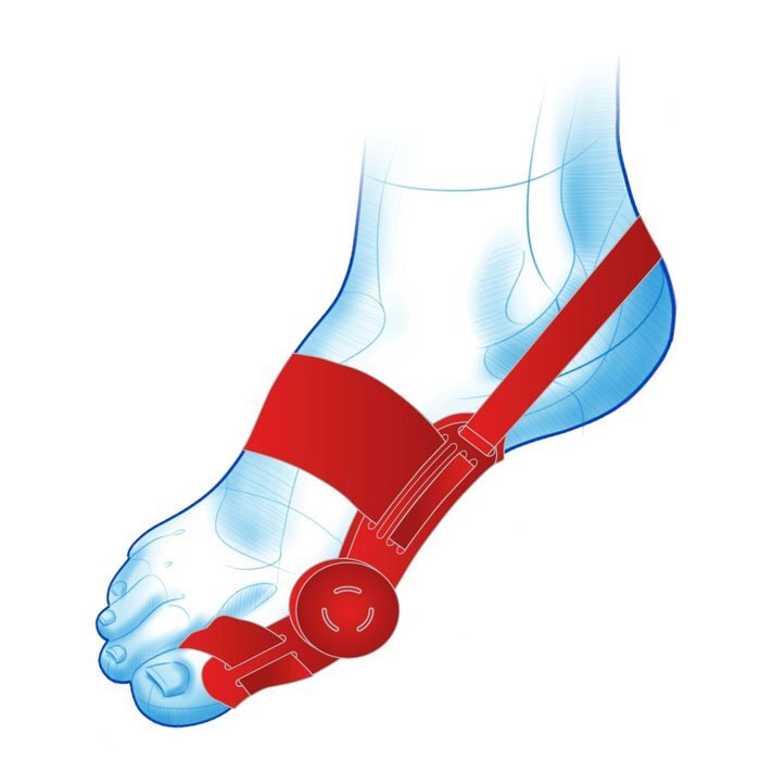Mazbit HALLUX REMEDIUM - aparat korekcyjny na haluksa