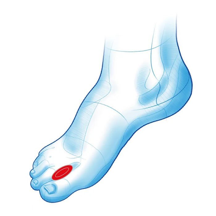 Mazbit HALUKS GEL - klin żelowy między palce