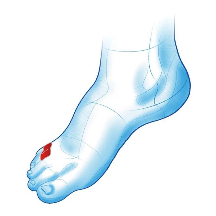 Mazbit SEPARATOR DUO MINI - podwójny separator z osłoną na palce