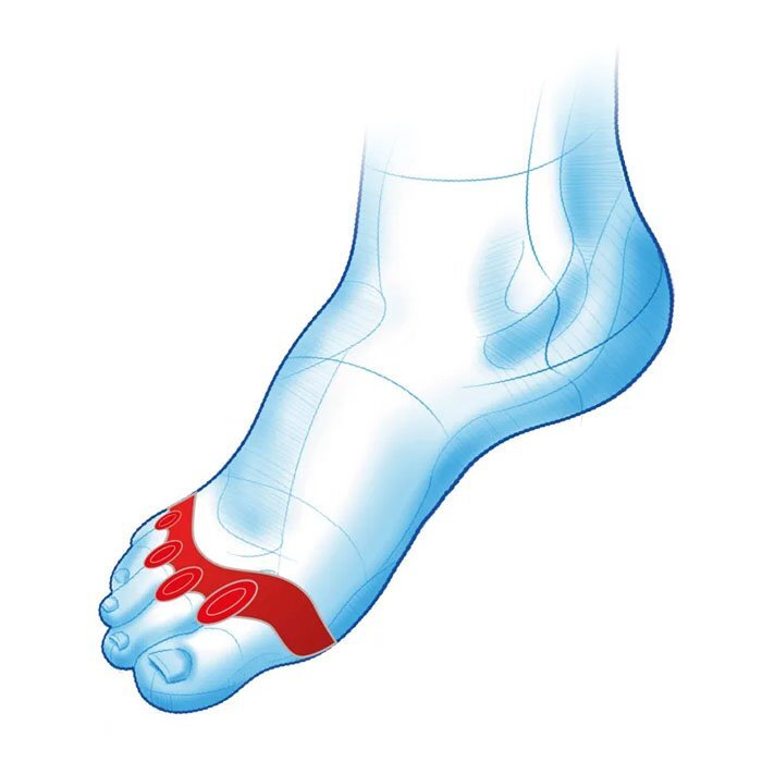 Mazbit SEPARATOR LUX - separator wszystkich placów z czterema klinami